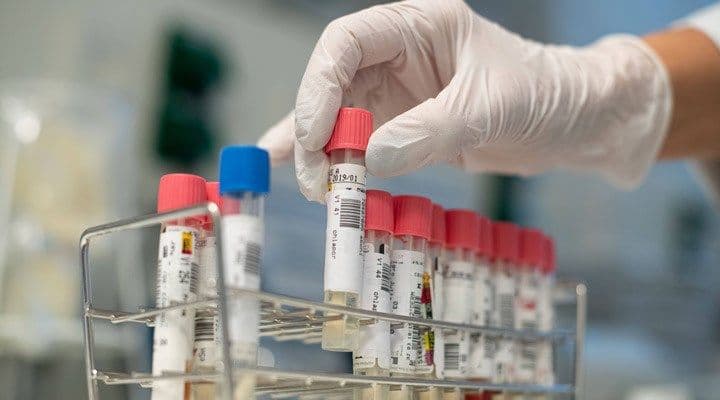 Azərbaycanda koronavirusla bağlı vəziyyəti açıqlandı